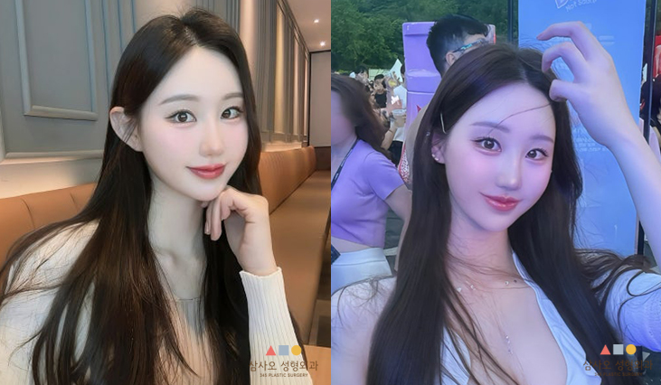 수술 후