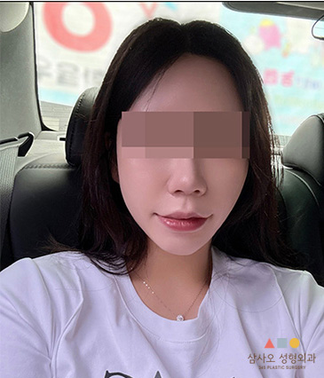 수술 후