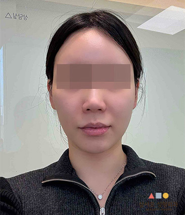 수술 전