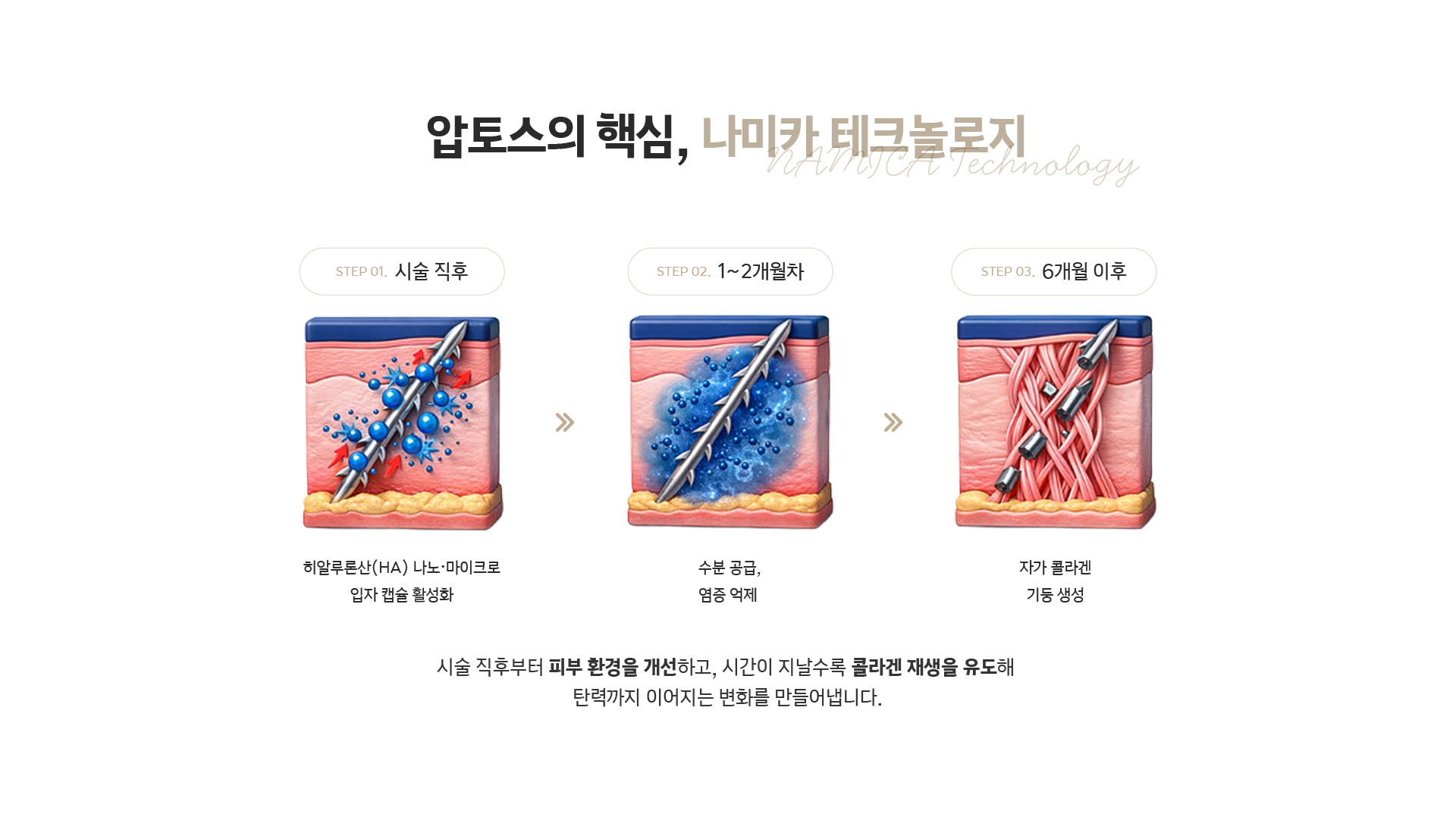 압토스의 핵심 나미카 테크놀로지 - 시술 직후 HA 캡슐 활성화, 1~2개월차 수분 공급과 염증 억제, 6개월 이후 자가 콜라겐 생성