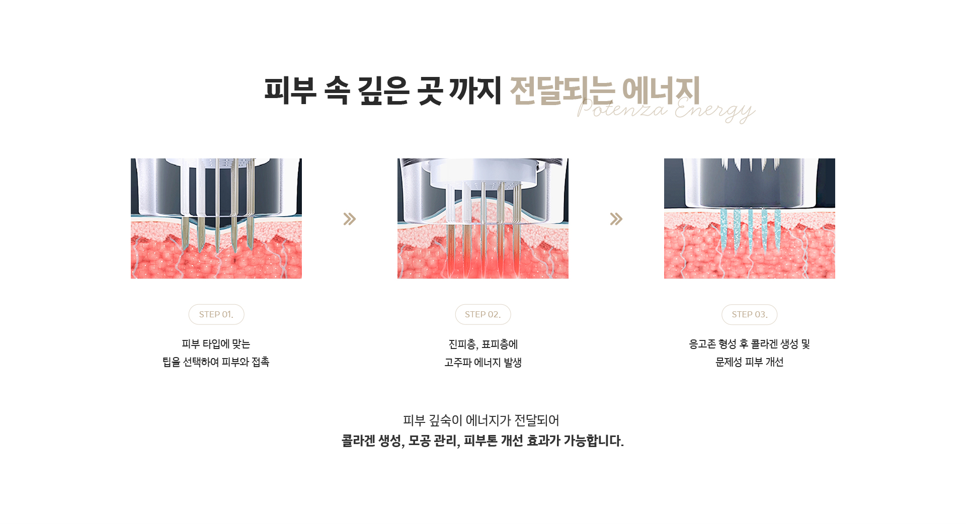 피부 속 깊은 곳까지 전달되는 포텐자 에너지 - 팁 선택 후 진피층 고주파 발생, 응고존 형성으로 콜라겐 생성과 피부톤 개선