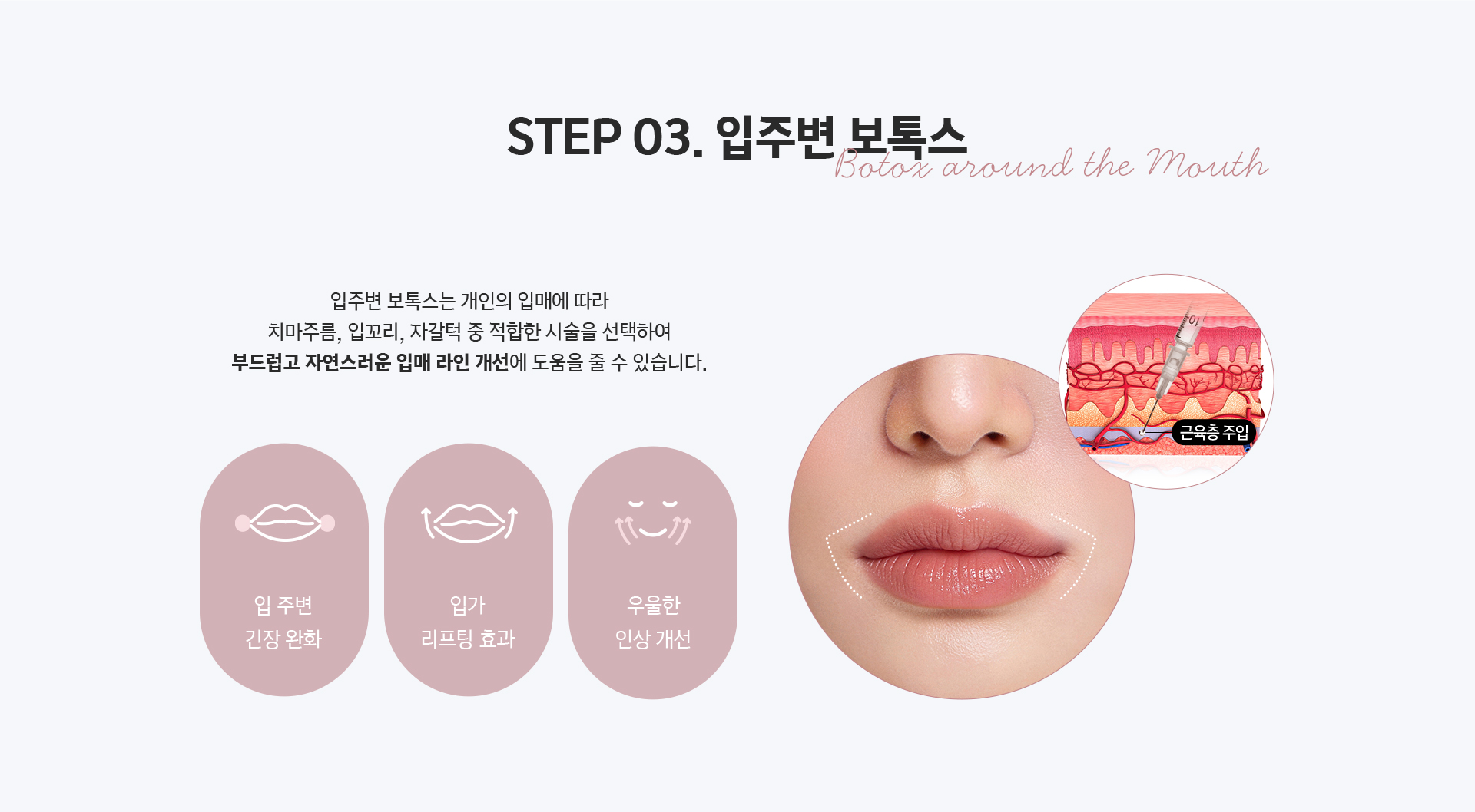 STEP03 입주변 보톡스 - 치마주름 입꼬리 자갈턱 중 맞춤 시술로 자연스러운 입매 라인 개선, 입 주변 긴장 완화와 리프팅 효과